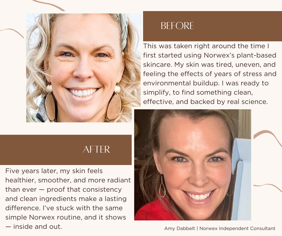 Amy's personal before-and-after photos with her written skincare story
